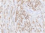 3255B | Control Slides:Immunopathology; Desmin